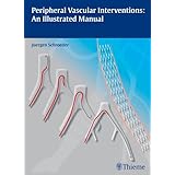 peripheral vascular interventions an illustrated manual