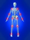 An Open-Label, Long-Term Safety and Tolerability Trial of Diclofenac Sodium 1% Gel in Patients with Knee Osteoarthritis (DOI: 10.3810/psm.2011.09.1918) (The Physician and Sportsmedicine)