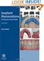 Implant Restorations: A Step-by-Step Guide