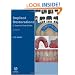 Implant Restorations: A Step-by-Step Guide