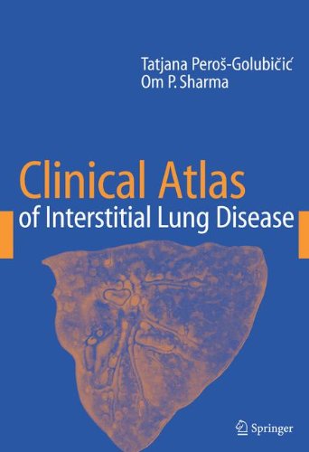 Clinical Atlas of Interstitial Lung Disease