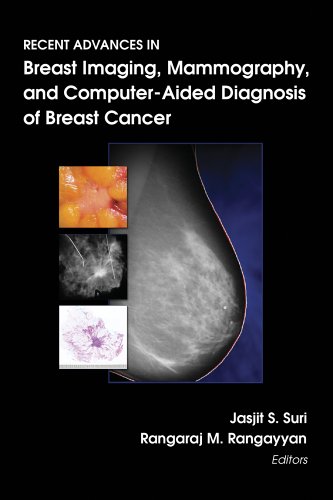 Mammography