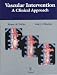 Book Vascular Intervention: A Clinical Approach
