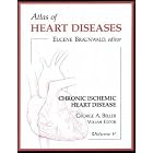 Chronic Ischemic Heart Disease: Chronic Ischemic Heart Disease (Atlas of Heart Diseases,... by George A., M.D. Beller and Eugene Braunwald