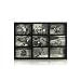 Melannco 9 opening Espresso Collage frame