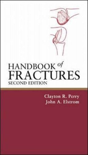 Handbook of Fractures
