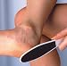 2-Sided Foot File