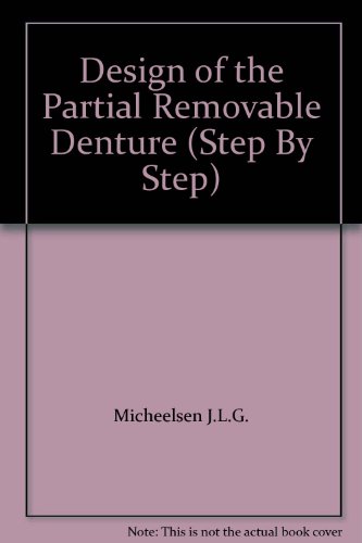 Design of the Partial Removable Denture (Step By Step)