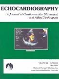 Echocardiography