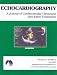 Echocardiography