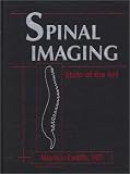 Spinal Imaging: State of the Art