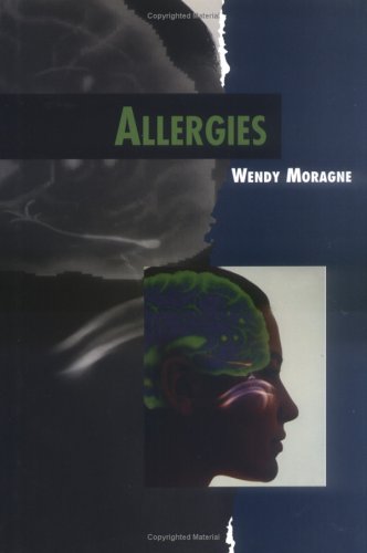 Allergies (Twenty-First Century Medical Library)