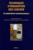 Techniques d irradiation des cancers : La radiothérapie conformationnelle