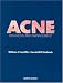   - Acne: Diagnosis and Management
