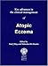 Key&nbsp;Advances&nbsp;in&nbsp;the&nbsp;Clinical&nbsp;Management&nbsp;of&nbsp;Atopic&nbsp;Eczema