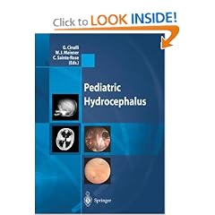 Pediatric Hydrocephalus by G. Cinalli, W.J. Maixner and C. Sainte-Rose