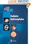Pediatric Hydrocephalus