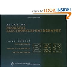 Atlas of Neonatal Electroencephalography by Eli M. Mizrahi, Richard A. Hrachovy and Peter Kellaway
