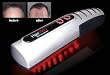 HairPro Laser Hair Treatment