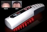 HairPro Laser Hair Treatment
