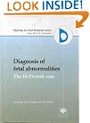 Diagnosis of Fetal Abnormalities: The 18-23-Week Scan