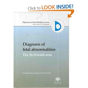 Click here to buy Diagnosis of Fetal Abnormalities: The 18-23-Week Scan by G. Pilu and K.H. Nicolaides.