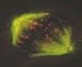 Book Genes and Disease - Complete Collection of Articles