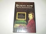 Burns now