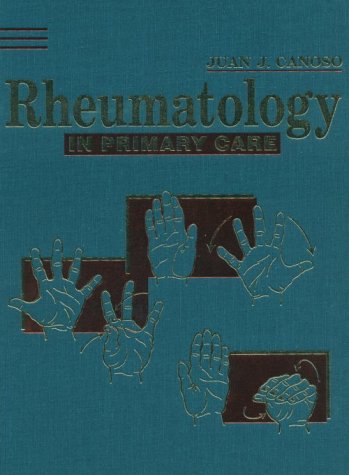 Connective-Tissue-Disorders