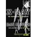 X-ray: The Unauthorized Autobiography
