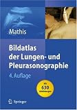 Produkt-Bild: Bildatlas der Lungen- und Pleurasonographie