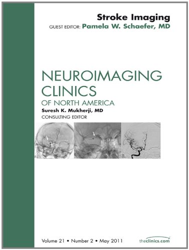 Stroke Imaging Update, An Issue of Neuroimaging Clinics (The Clinics: Internal Medicine)