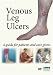 Venous Leg Ulcers: a guide for patients and care givers