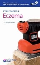 Eczema (Understanding)