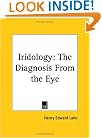 Iridology: The Diagnosis From the Eye