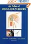 Atlas of Shoulder Surgery