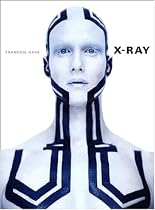 X-Ray (French Edition)