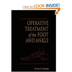 Operative Treatment of the Foot and Ankle