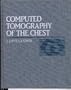 Computed Tomography of the Chest