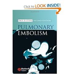Pulmonary Embolism by Paul D. Stein