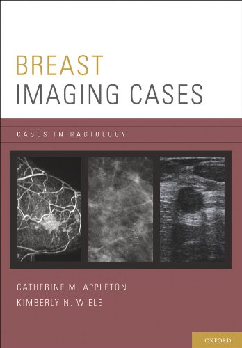 Breast Imaging Cases (Cases in Radiology)