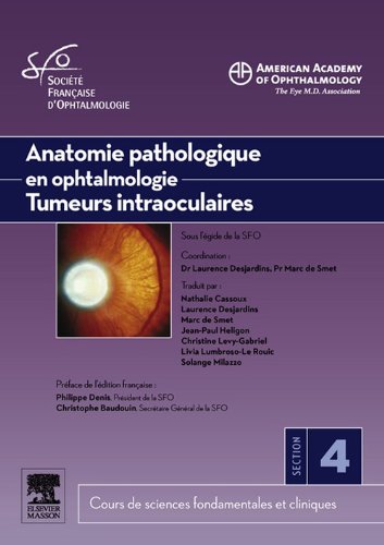 Anatomie pathologique en ophtalmologie. Tumeurs intraoculaires (French Edition)