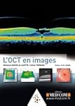 L'OCT en images