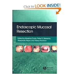 Endoscopic Mucosal Resection by Massimo Conio, Pieter Siersema, Alessandro Repici and Thierry Ponchon