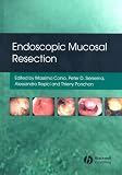 Endoscopic Mucosal Resection