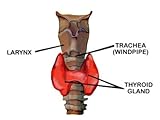 Thyroid Gland Location Anterior Graphics Labeled Stretched Canvas Poster Print, 30x40