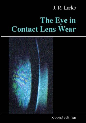 Contact-Lenses