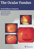 The Ocular Fundus: From Findings to Diagnosis