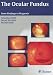 The Ocular Fundus: From Findings to Diagnosis bij Boeken bij de naam: 4191K1JSEVL._SL75_