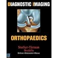 Diagnostic Imaging: Orthopaedics by  David Stoller, Phillip Tirman, Miriam Bredella, and Robert Branstetter